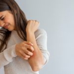 Uncovering the Typical Symptoms of Plaque Psoriasis